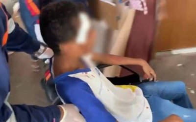 Aluno de 15 anos é esfaqueado na cabeça na saída de escola em Araguaína