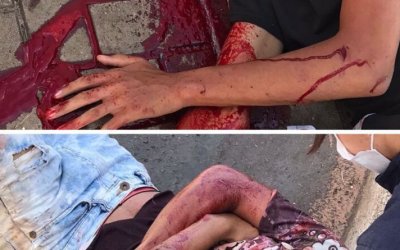 Dupla em motocicleta fica gravemente ferida após colisão com ônibus em Araguaína