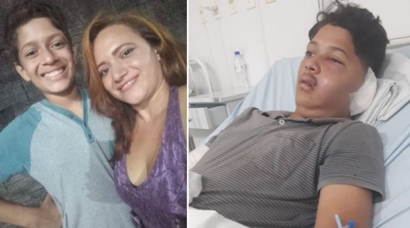 Adolescente de AraguaÃna baleado pelo próprio pai já arrecadou R$ 100 mil para tratamento médico e recomeço de vida