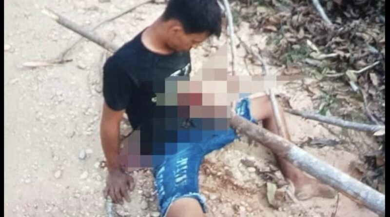 Homem fica com tronco atravessado no corpo após acidente de moto