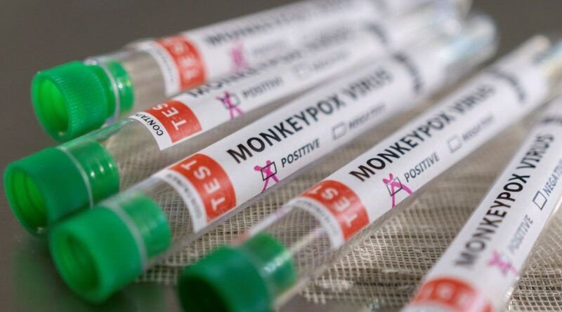 Tocantinense diagnosticado com varíola dos macacos é de  Nazaré